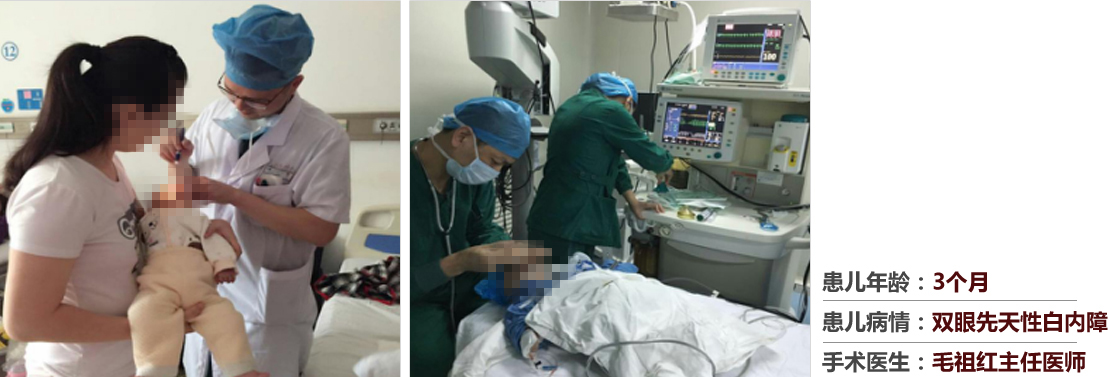 患兒年齡：3個(gè)月，患兒病情：雙眼先天性白內(nèi)障，手術(shù)醫(yī)生：毛祖紅主任醫(yī)師