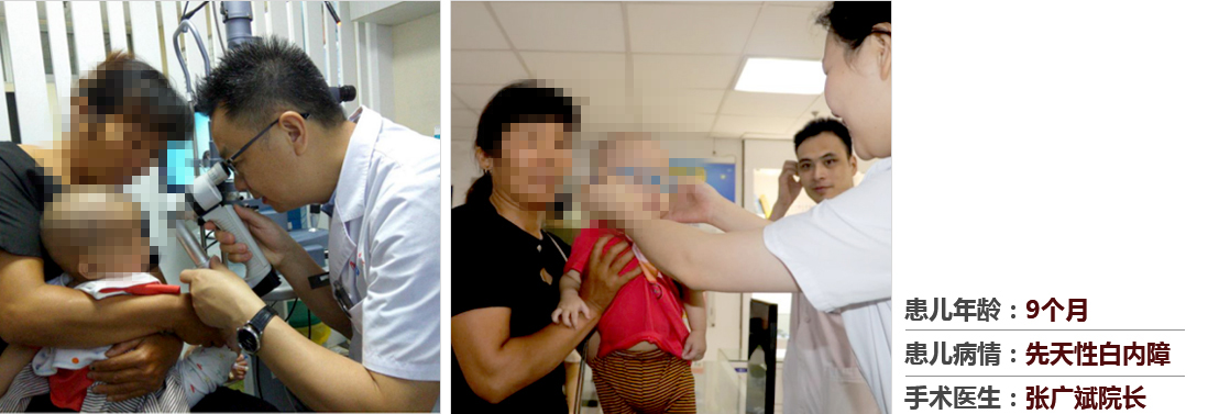 患兒年齡：9個(gè)月，患兒病情：先天性白內(nèi)障，手術(shù)醫(yī)生：張廣斌院長(zhǎng)